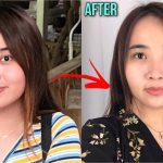 Pipi Chubby? No More! Temukan Taktik Jitu Memancungkan Wajah